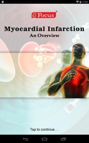 Myocardial infarction